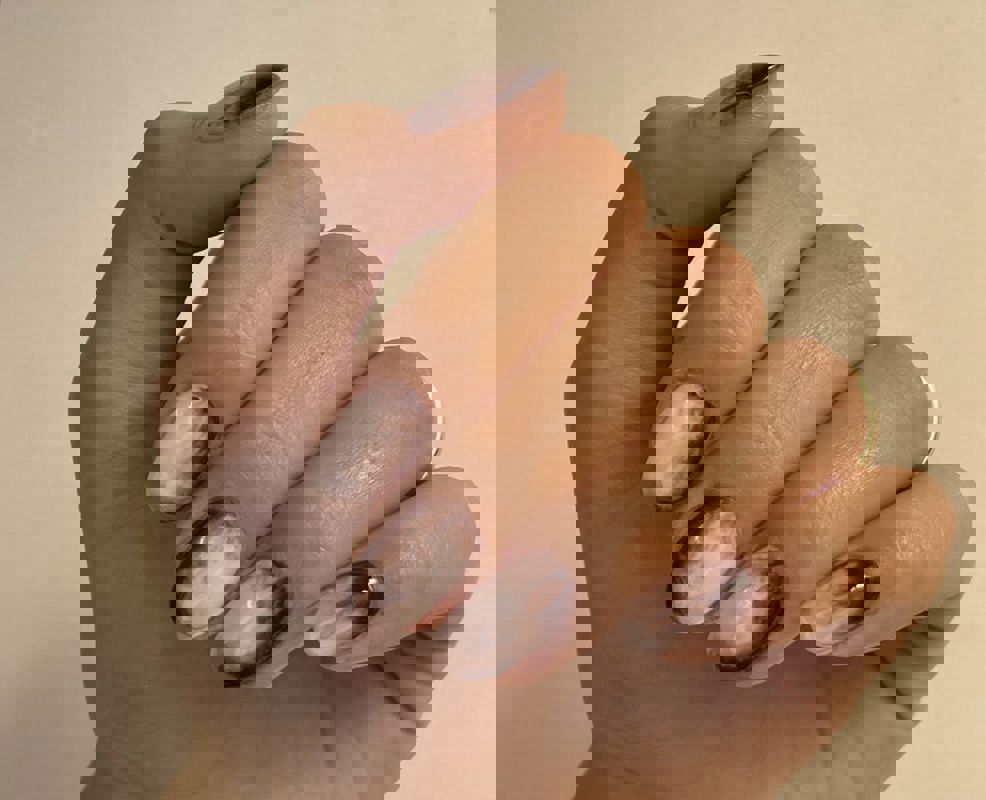 کاشت و ترمیم ناخن