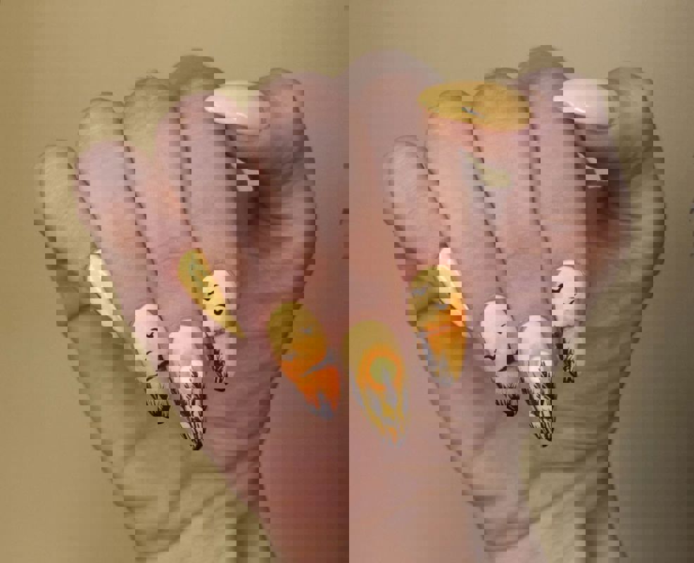 کاشت و ترمیم ناخن