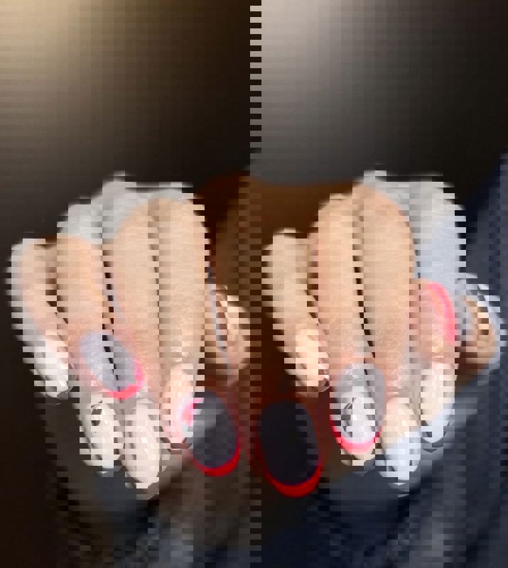 کاشت و ترمیم ناخن