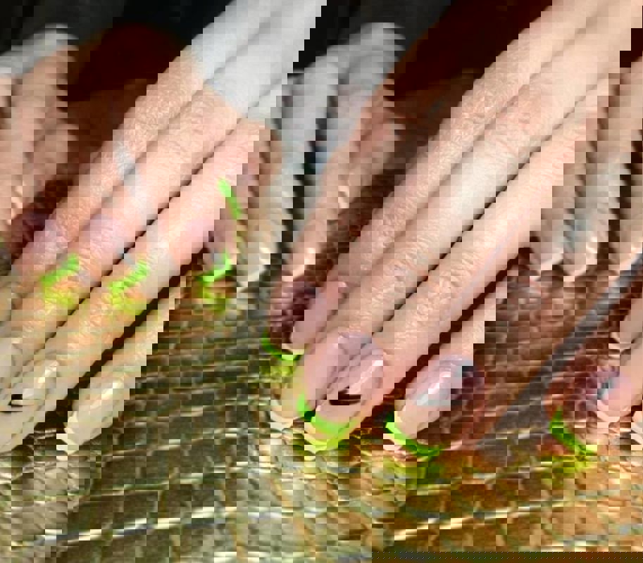 کاشت و ترمیم ناخن